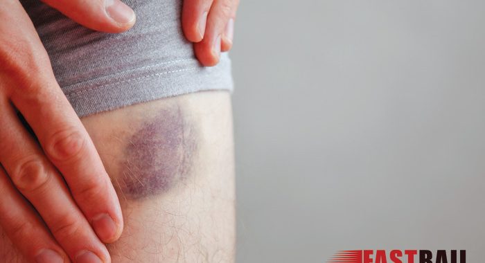 What is a Corporal Injury?